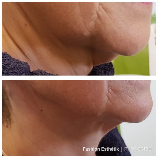  Institut de Beauté Fashion Esthetik TARBES